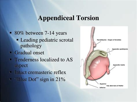 Torsion of the Testicular Appendices and Epididymis Treatment 